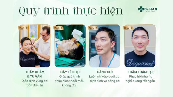Căng chỉ da mặt – Bí quyết trẻ hóa da không cần phẫu thuật缩略图
