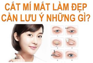 Cắt mí xong kiêng gì để nhanh hồi phục, không để lại sẹo?缩略图