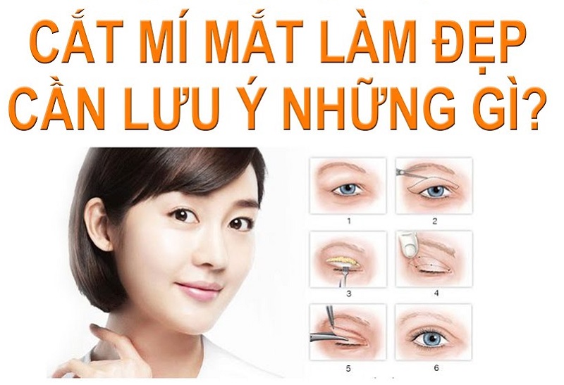 Cắt mí xong kiêng gì để nhanh hồi phục, không để lại sẹo?缩略图
