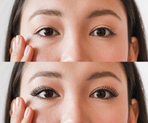 Cắt mí size 7 có phải size cắt mí đẹp tự nhiên?缩略图