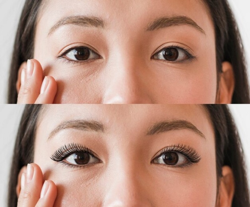 Cắt mí size 7 có phải size cắt mí đẹp tự nhiên?缩略图