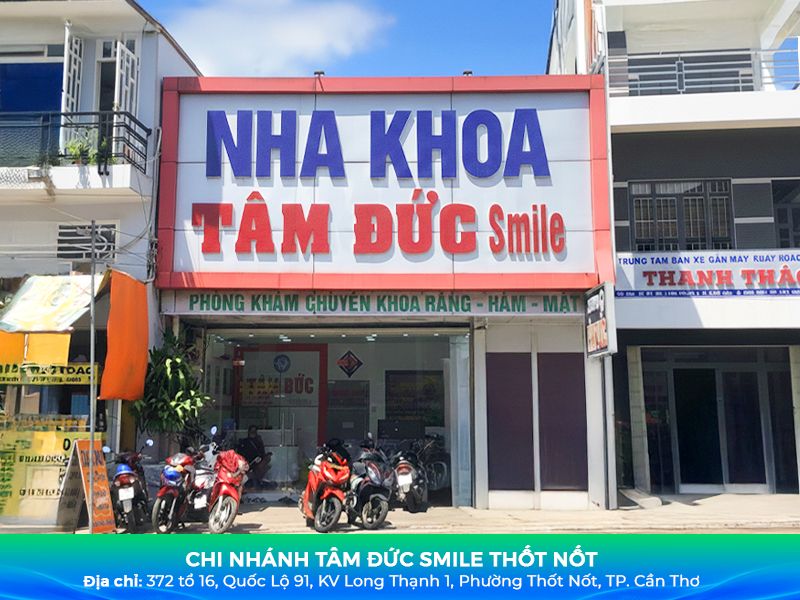 Nha khoa Thốt Nốt uy tín – Niềng răng, Bọc sứ, Implant giá tốt缩略图