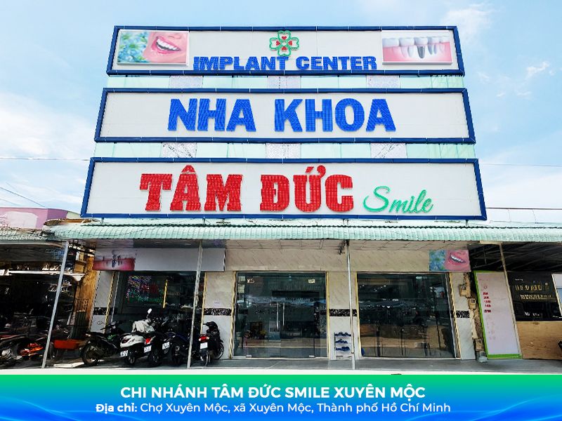 Nha khoa Xuyên Mộc uy tín – Niềng răng, Bọc sứ, Implant giá tốt缩略图
