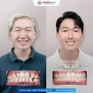 Khách hàng: Chí Vỹ缩略图