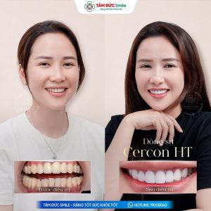 Khách hàng: Phan Thị Diễm缩略图