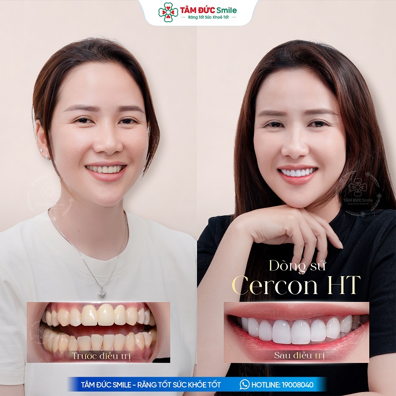 Khách hàng: Phan Thị Diễm缩略图