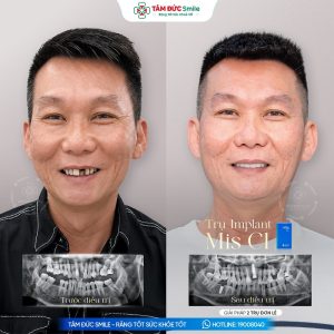 Khách hàng: Đức Trần缩略图
