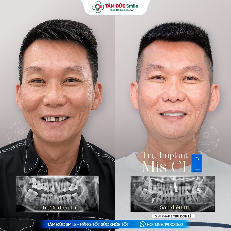 Khách hàng: Đức Trần缩略图