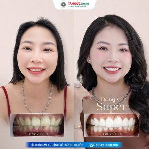 Khách hàng: Ngọc Hà缩略图
