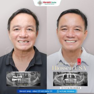 Khách hàng: Quốc Hùng缩略图
