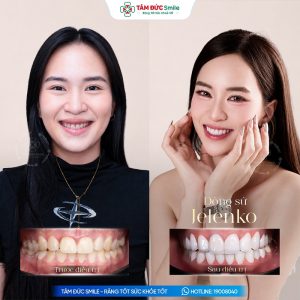 Khách hàng: Thanh Ngân缩略图