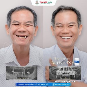 Khách hàng: Thanh Sơn缩略图