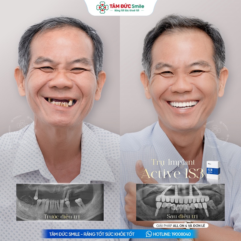 Khách hàng: Thanh Sơn缩略图
