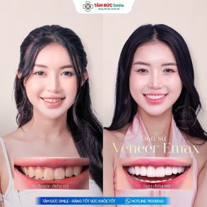 Khách hàng: Thùy Trang缩略图