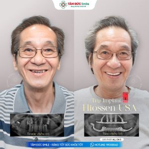 Khách hàng: Trần Lợi缩略图