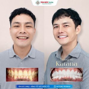 Khách hàng: Trí Anh缩略图