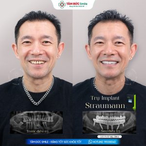 Khách hàng: Trọng Thuần缩略图
