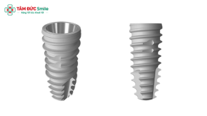Trụ Implant Active IS3 – Giải pháp trồng răng hiện đại với độ bền cao và tích hợp xương nhanh缩略图