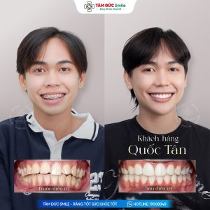Khách hàng: Quốc Tân缩略图