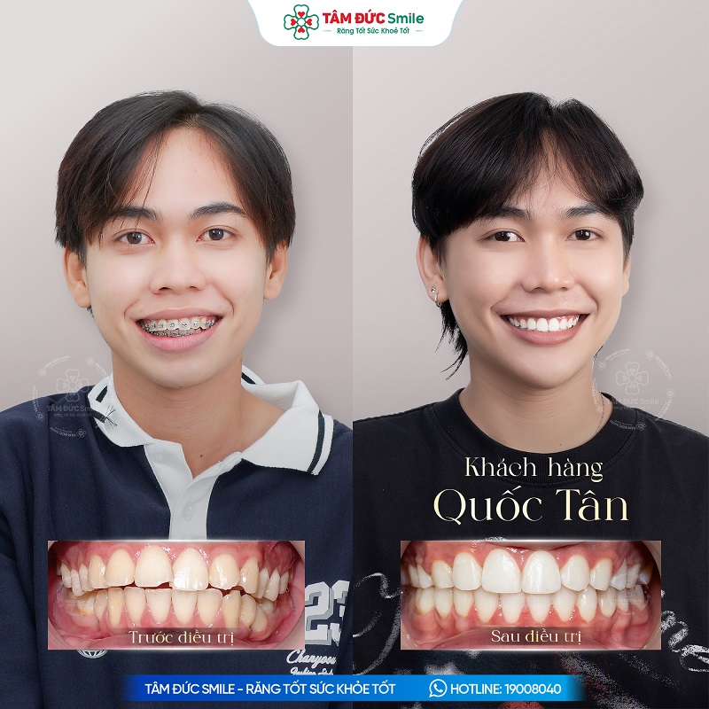 Khách hàng: Quốc Tân缩略图 Khách hàng: Quốc Tân缩略图