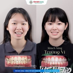 Khách hàng: Trường Vi缩略图
