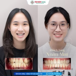 Khách hàng: Xuân Mai缩略图
