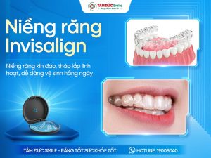 Niềng răng Invisalign là gì? Ưu nhược điểm, Quy trình và Chi phí缩略图