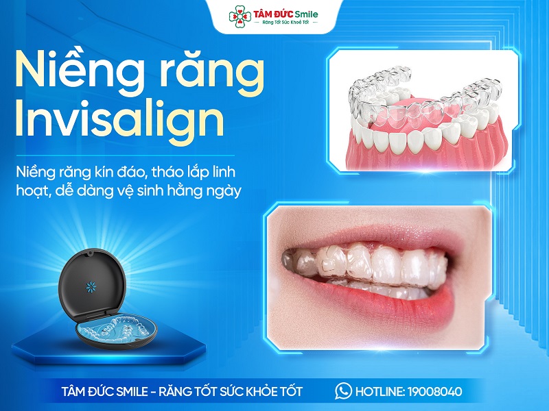 Niềng răng Invisalign là gì? Ưu nhược điểm, Quy trình và Chi phí缩略图 Niềng răng Invisalign là gì? Ưu nhược điểm, Quy trình và Chi phí缩略图